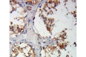 #VALUE! (COMP antibody  (AA 123-240))