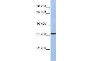Western Blotting (WB) image for anti-Solute Carrier Family 25, Member 28 (SLC25A28) antibody (ABIN2458805) (SLC25A28 antibody)