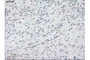 Immunohistochemical staining of paraffin-embedded lung tissue using anti-NEUROG1mouse monoclonal antibody. (Neurogenin 1 antibody)
