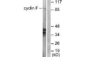Western blot analysis of extracts from HeLa cells, using Cyclin F antibody (#C0168). (Cyclin F antibody)