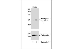 Western blot analysis of lysates from Hela cell line, untreated or treated with 20 % FBS + 100nM Calyculin A, using Phospho-HIST1H3B3(S10) Antibody (upper) or Beta-actin (lower).