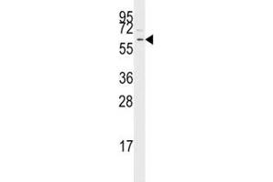 Western blot analysis of TGF Beta Receptor antibody and Jurkat lysate