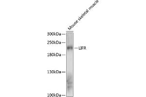 Western blot analysis of extracts of mouse skeletal muscle, using LIFR antibody (ABIN6132110, ABIN6143204, ABIN6143205 and ABIN6216534) at 1:3000 dilution. (LIFR antibody  (AA 500-700))
