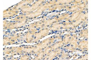 ABIN6259879 and ABIN6278421 at 1/100 staining Mouse kidney tissue by IHC-P. (ALDH3A1 antibody  (C-Term))