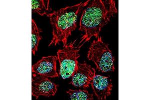 Fluorescent confocal image of  cell stained with FOXO6 Antibody (Center) (ABIN1881351 and ABIN2845586). (Foxo6 antibody  (AA 154-181))