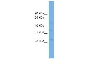 WB Suggested Anti-MBL2 Antibody Titration:  0. (MBL2 antibody  (Middle Region))