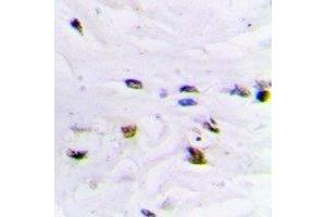 Immunohistochemical analysis of ZNF7 staining in human brain formalin fixed paraffin embedded tissue section.