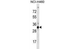 Western Blotting (WB) image for anti-Olfactory Receptor, Family 9, Subfamily G, Member 4 (OR9G4) antibody (ABIN2998705)