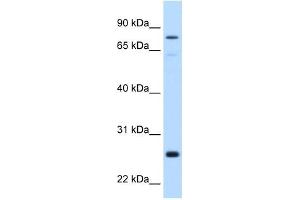 GSTM2 antibody used at 0. (GSTM2 antibody)
