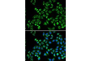Immunofluorescence analysis of HeLa cells using C1QBP antibody (ABIN5970966).