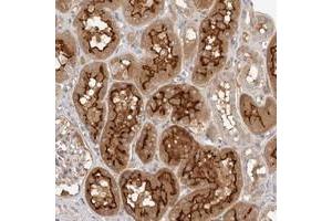 Immunohistochemical staining of human kidney with MICALL2 polyclonal antibody  shows strong cytoplasmic and membrane positivity in cells in tubules.