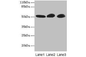 Western blot All lanes: GDI2 antibody at 2 μg/mL Lane 1: Mouse brain tissue Lane 2: HepG2 whole cell lysate Lane 3: MCF-7 whole cell lysate Secondary Goat polyclonal to rabbit IgG at 1/10000 dilution Predicted band size: 51, 46 kDa Observed band size: 51 kDa (GDI2 antibody  (AA 1-445))