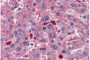 Human Liver: Formalin-Fixed, Paraffin-Embedded (FFPE) (CBS antibody  (AA 1-101))