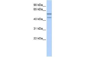 WB Suggested Anti-ZNF474 Antibody Titration:  0. (ZNF474 antibody  (N-Term))