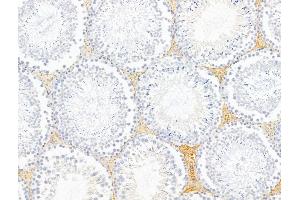 ABIN6260885 and ABIN6268761 at 1/100 staining Rat testis tissue by IHC-P. (Claudin 6 antibody  (Internal Region))