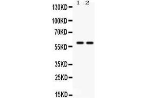 Anti- TH Picoband antibody, Western blotting All lanes: Anti TH  at 0. (TH antibody  (Middle Region))