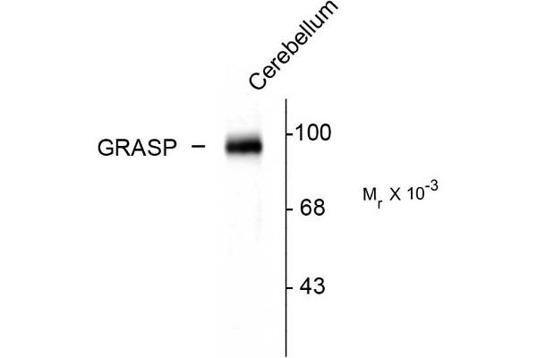 GRIPAP1 antibody  (C-Term)