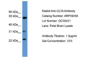 WB Suggested Anti-CLTA  Antibody Titration: 0.