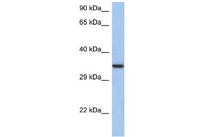 WB Suggested Anti-HORMAD2 Antibody Titration: 0.