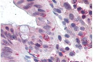 Image no. 2 for anti-Leucine-Rich Repeat Containing G Protein-Coupled Receptor 5 (LGR5) (Cytoplasmic Domain) antibody (ABIN1048834) (LGR5 antibody  (Cytoplasmic Domain))