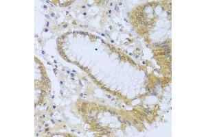 Immunohistochemistry of paraffin-embedded human stomach using ACP1 antibody at dilution of 1:100 (x40 lens). (ACP1 antibody)