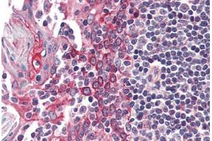 Human Tonsil (formalin-fixed, paraffin-embedded) stained with CSNK1E antibody ABIN337139 at 5 ug/ml followed by biotinylated anti-goat IgG secondary antibody ABIN481715, alkaline phosphatase-streptavidin and chromogen. (CK1 epsilon antibody  (AA 403-416))