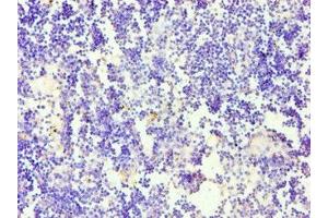 Immunohistochemistry of paraffin-embedded human thymus tissue using ABIN7158650 at dilution of 1:100 (CD58 antibody  (AA 40-220))