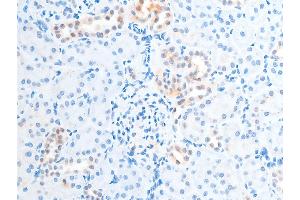 Immunohistochemistry (IHC) image for anti-Checkpoint Kinase 2 (CHEK2) (pThr387) antibody (ABIN6256554)