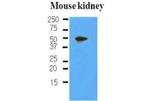 Western Blotting (WB) image for anti-Podoplanin (PDPN) antibody (ABIN361104) (Podoplanin antibody)