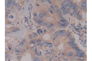 Immunohistochemistry (IHC) image for anti-rho-Associated, Coiled-Coil Containing Protein Kinase 2 (ROCK2) (AA 904-1140) antibody (ABIN7434197)