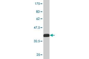 Western Blot detection against Immunogen (36. (MPP1 antibody  (AA 1-98))