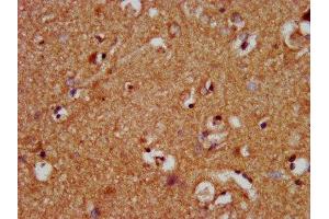 IHC image of ABIN7160821 diluted at 1:400 and staining in paraffin-embedded human brain tissue performed on a Leica BondTM system. (NLRP1 antibody  (AA 589-655))