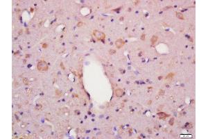 Formalin-fixed and paraffin embedded rat brain labeled with Anti-Frizzled 6 Polyclonal Antibody, Unconjugated  at 1:200 followed by conjugation to the secondary antibody and DAB staining (FZD6 antibody  (AA 11-110))