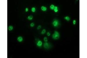 Anti-TP53 mouse monoclonal antibody (ABIN2454501) immunofluorescent staining of COS7 cells transiently transfected by pCMV6-ENTRY TP53 (RC200003). (p53 antibody)