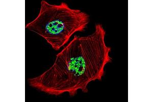 Fluorescent confocal image of SK-BR-3 cell stained with USF1 Antibody (Center) (ABIN655030 and ABIN2844661). (USF1 antibody  (AA 174-201))