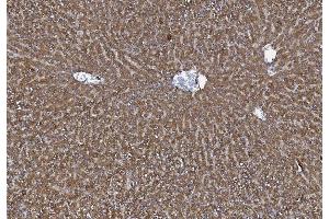 IHC analysis of MTTP using anti-MTTP antibody (ABIN7601145). (MTTP antibody  (AA 29-702))