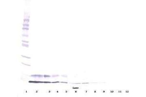 Image no. 1 for anti-Insulin-Like Growth Factor 1 (IGF1) antibody (ABIN464965) (IGF1 antibody)