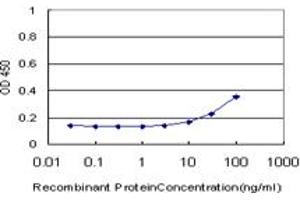 Detection limit for recombinant GST tagged GTF3A is approximately 10ng/ml as a capture antibody. (GTF3A antibody  (AA 185-274))