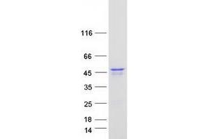 Western Blotting (WB) image for PIN2/TERF1 Interacting, Telomerase Inhibitor 1 (PINX1) protein (Myc-DYKDDDDK Tag) (ABIN2728997)
