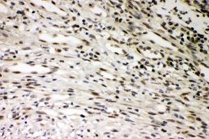 IHC analysis of SMURF1 using anti-SMURF1 antibody (ABIN3044547). (SMURF1 antibody  (Middle Region))