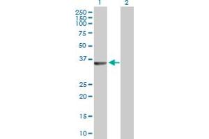 Western Blot analysis of RLBP1 expression in transfected 293T cell line by RLBP1 MaxPab polyclonal antibody. (RLBP1 antibody  (AA 1-317))