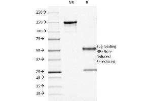 SDS-PAGE Analysis Purified CD68 Mouse Monoclonal Antibody (KP1). (CD68 antibody)