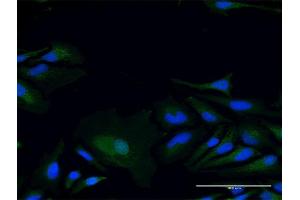 Immunofluorescence of purified MaxPab antibody to LY96 on HeLa cell. (LY96 antibody  (AA 19-160))