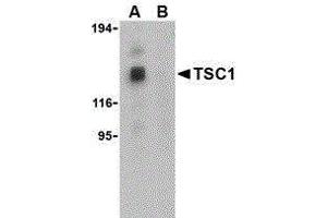 Western Blotting (WB) image for anti-Tuberous Sclerosis 1 (TSC1) (Center) antibody (ABIN2476985) (TSC1 antibody  (Center))