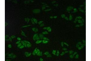 Detection of CAPN2 in Human Hela Cells using Polyclonal Antibody to Calpain 2 (CAPN2) (Calpain 2 antibody  (AA 45-514))