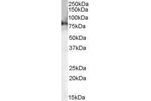 ABIN185635 (0. (Choline Acetyltransferase antibody  (C-Term))