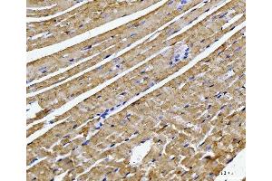IHC analysis of ATP5F1B using anti-ATP5F1B antibody (ABIN7599866). (Atp5f1b (AA 123-529) antibody)