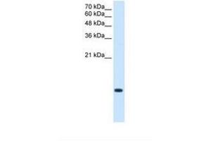 BRK1 anticorps  (C-Term)