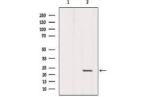 Western blot analysis of extracts from Mouse liver, using Dermatopontin Antibody.