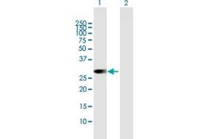 Western Blot analysis of RAB23 expression in transfected 293T cell line by RAB23 MaxPab polyclonal antibody. (RAB23 antibody  (AA 1-237))